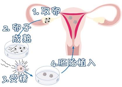 关于冰原生殖